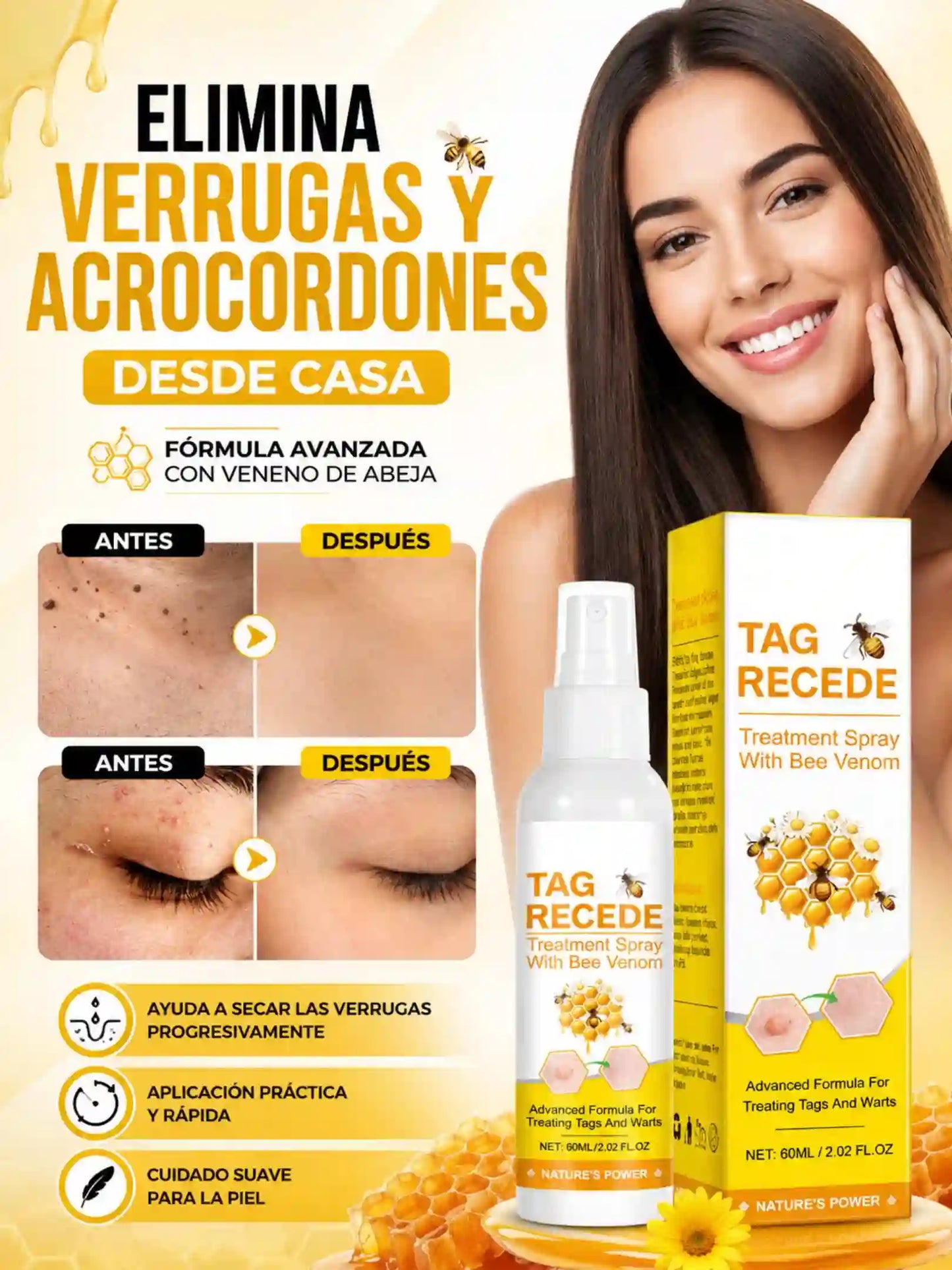SPRAY PARA VERRUGAS Y ACROCORDONES