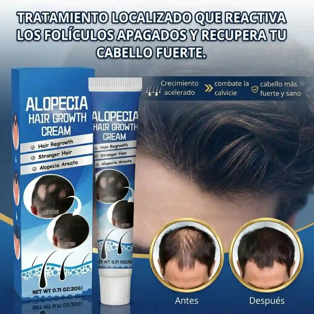ALOPECIA. RESTAURA TU CABELLO