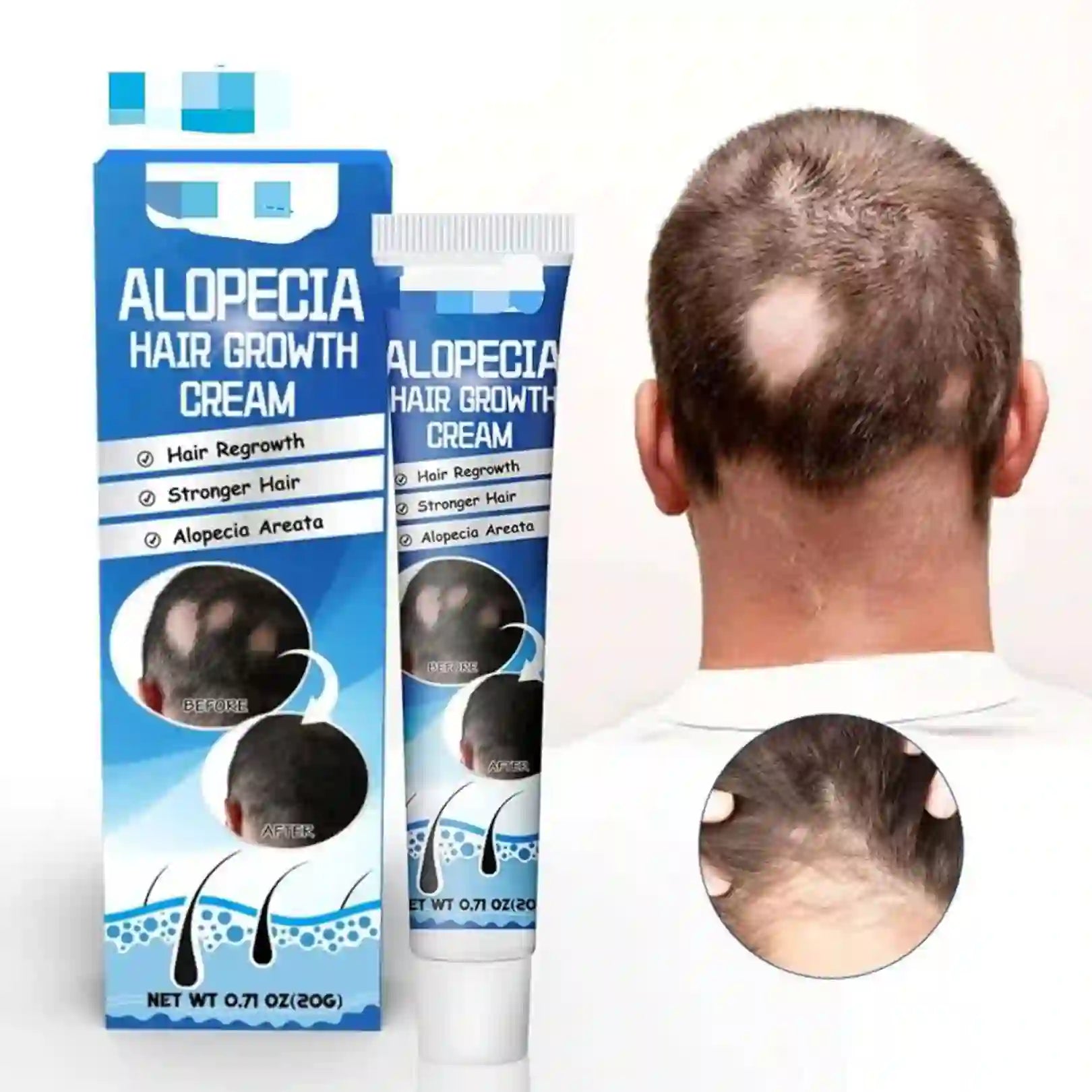 ALOPECIA RESTAURA TU CABELLO.