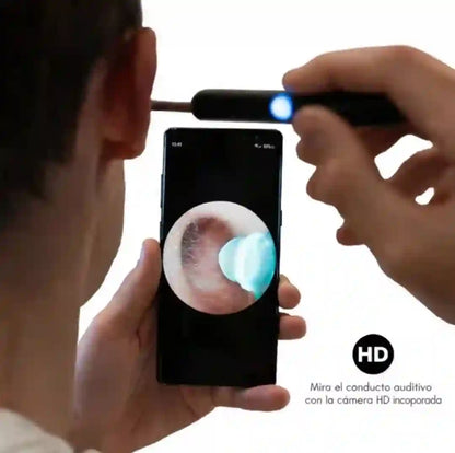 LIMPIADOR DE OÍDOS INTELIGENTE CON CÁMARA HD