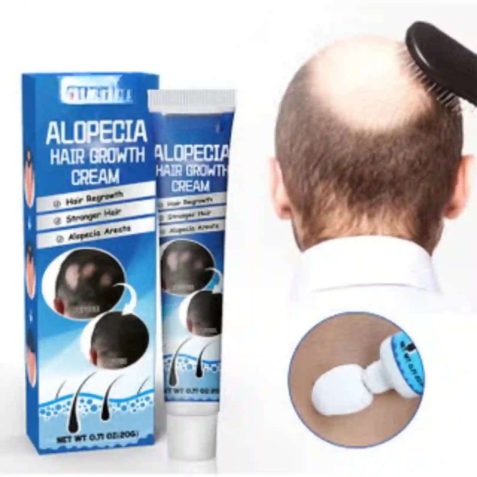 ALOPECIA RESTAURA TU CABELLO.