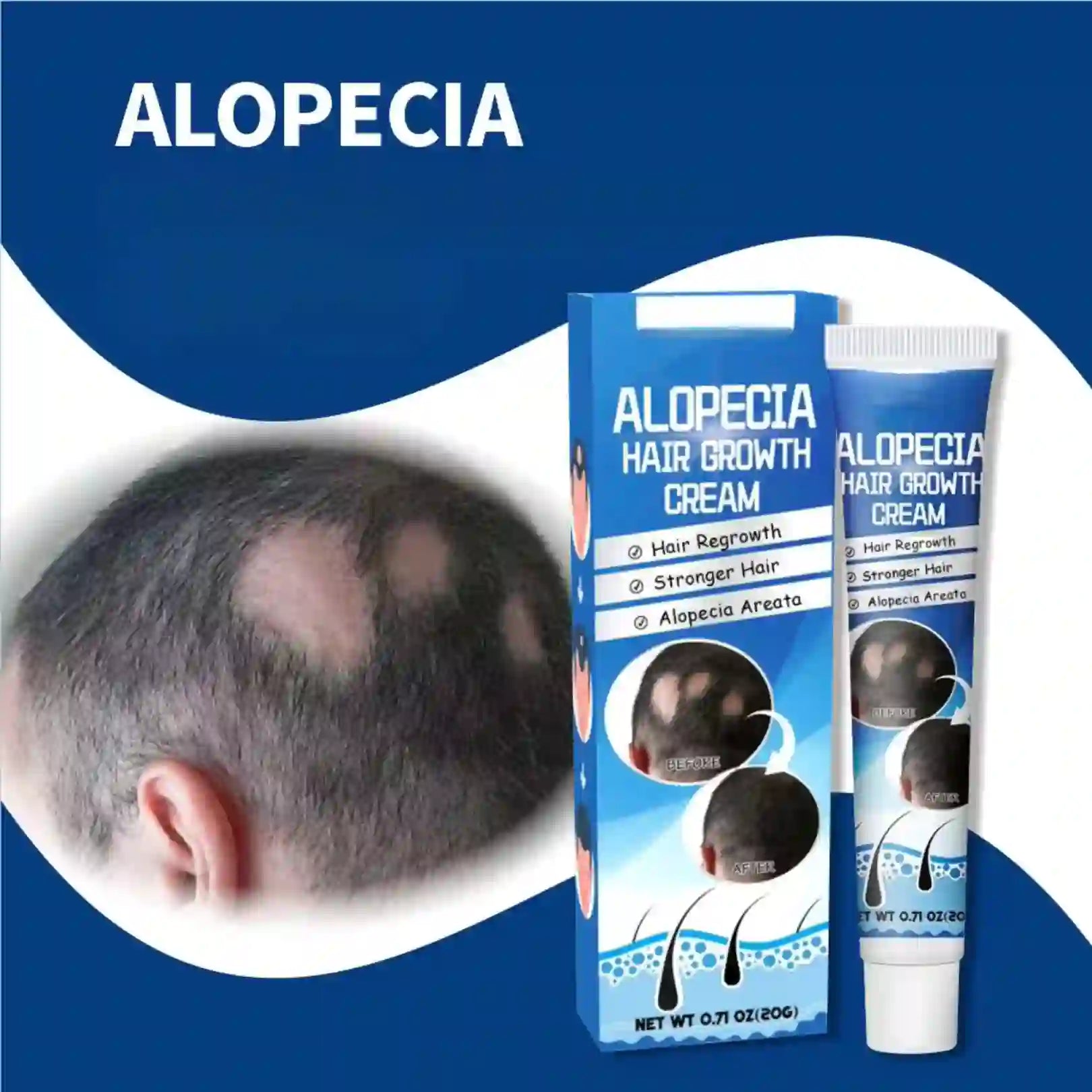 ALOPECIA RESTAURA TU CABELLO.